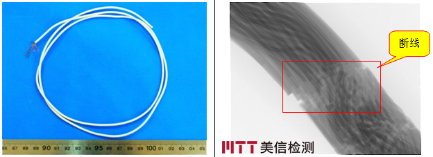 x-ray檢測